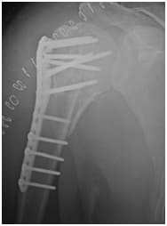 orthopedic surgeon in paldi